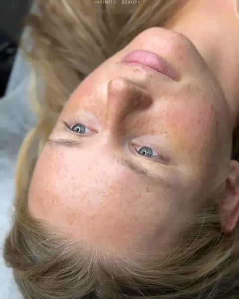 Čerstvý microblading u klientky s pihami